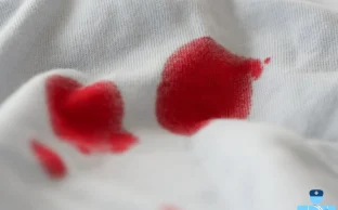 پاک کردن لکه خون از روی لباس